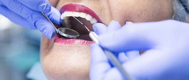 Best Emergency Tooth Extraction in Stockton, KS